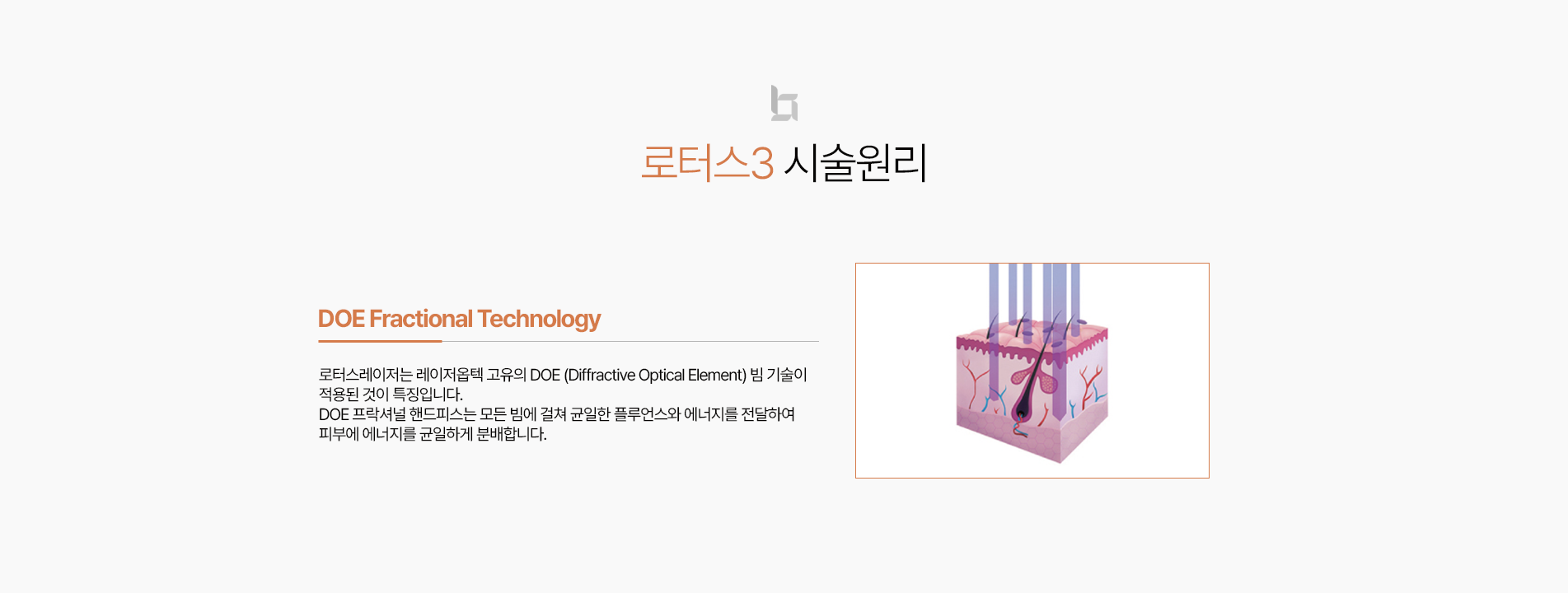 로터스 시술원리