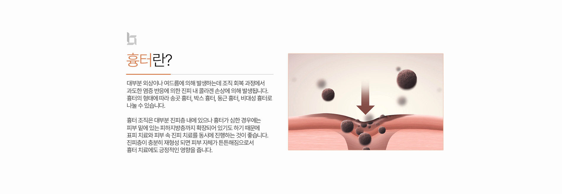 흉터 소개