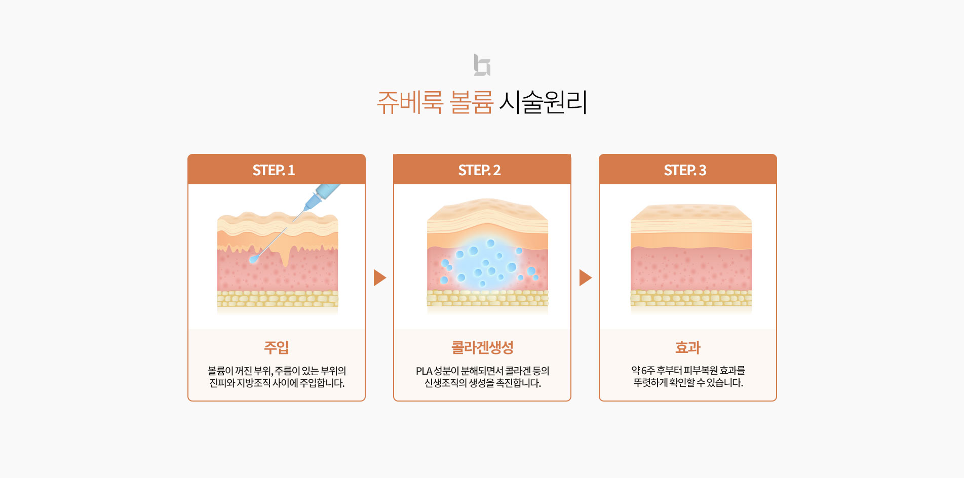 쥬베룩 볼륨 시술원리