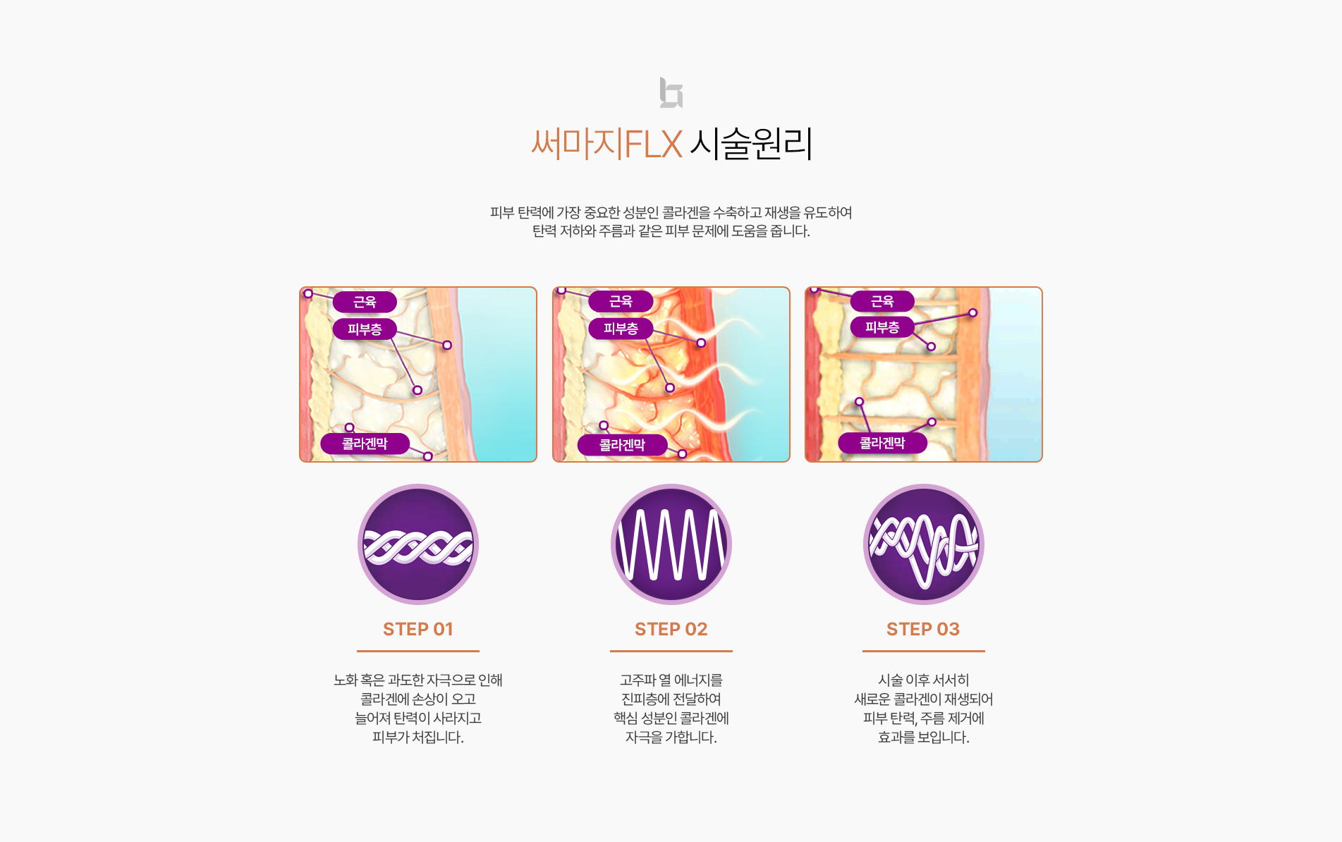 써마지 시술원리