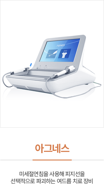 아그네스