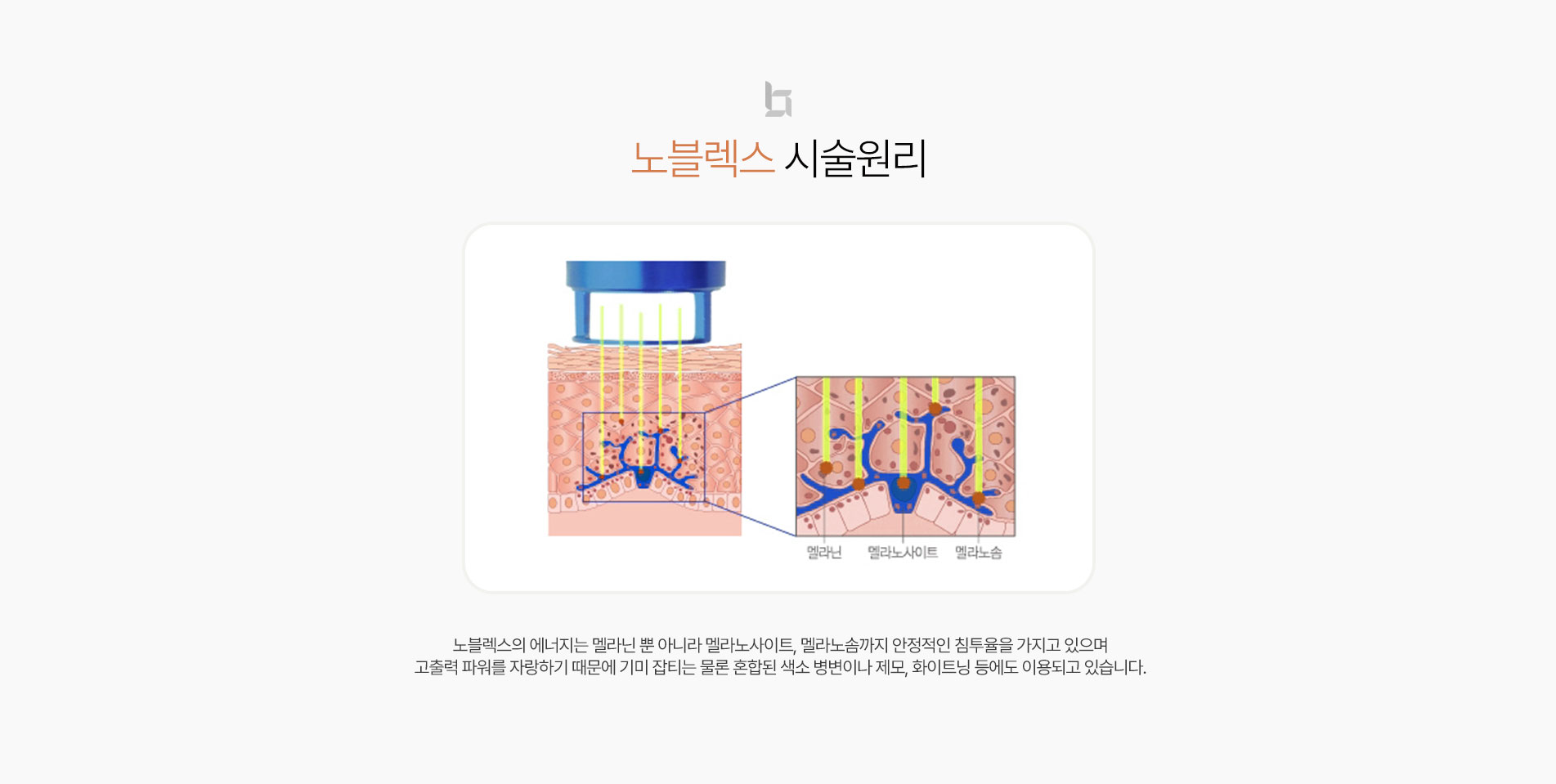 노블렉스 시술원리